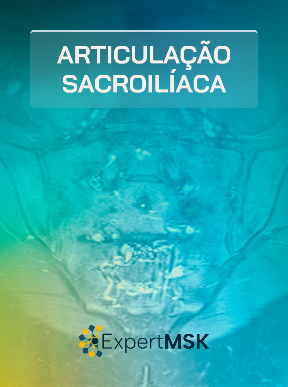 Articulação Sacroilíaca