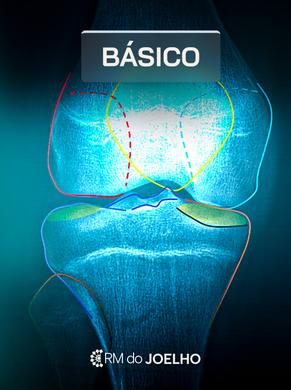 MÓD 1 - BÁSICO