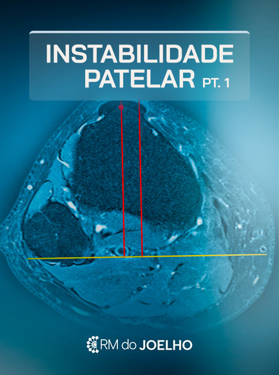 MÓD 11 - INSTABILIDADE PATELAR PT 1