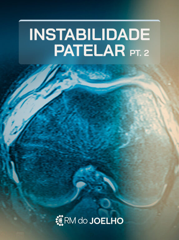 MÓD 12 - INSTABILIDADE PATELAR PT 2
