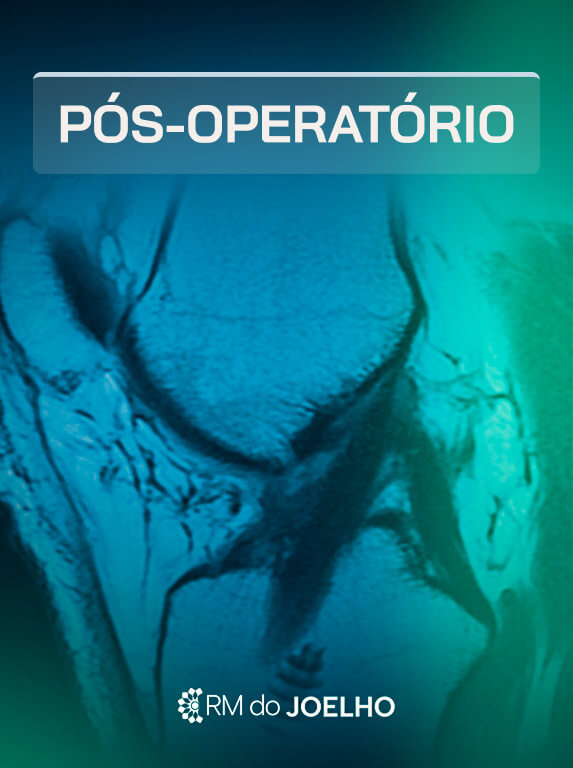 MÓD 13 - JOELHO OPERADO