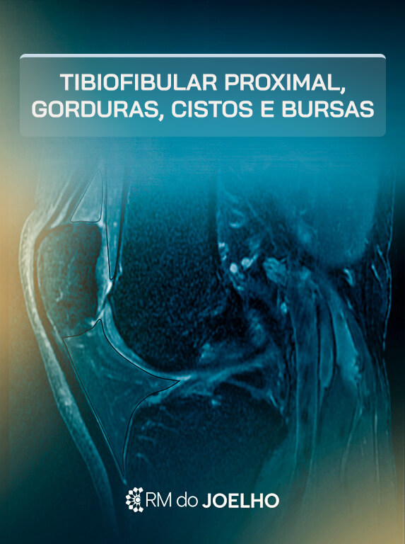 MÓD 14 - TIBIOFIBULAR