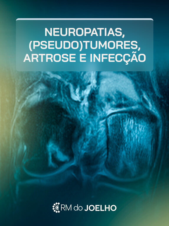 MÓD 15 - NEUROPATIAS