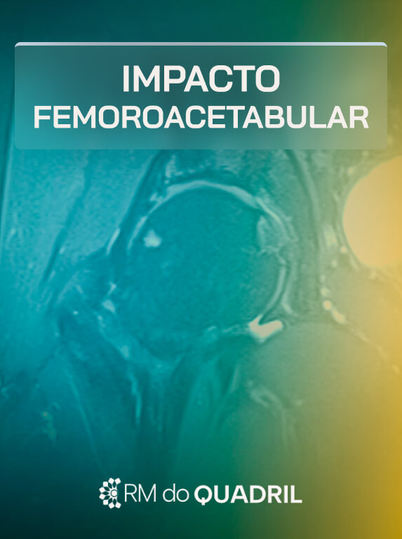 MÓD 2 - IMPACTO FEMOROACETABULAR