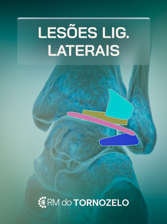 MÓD 2 - Lesões Lig. Laterais