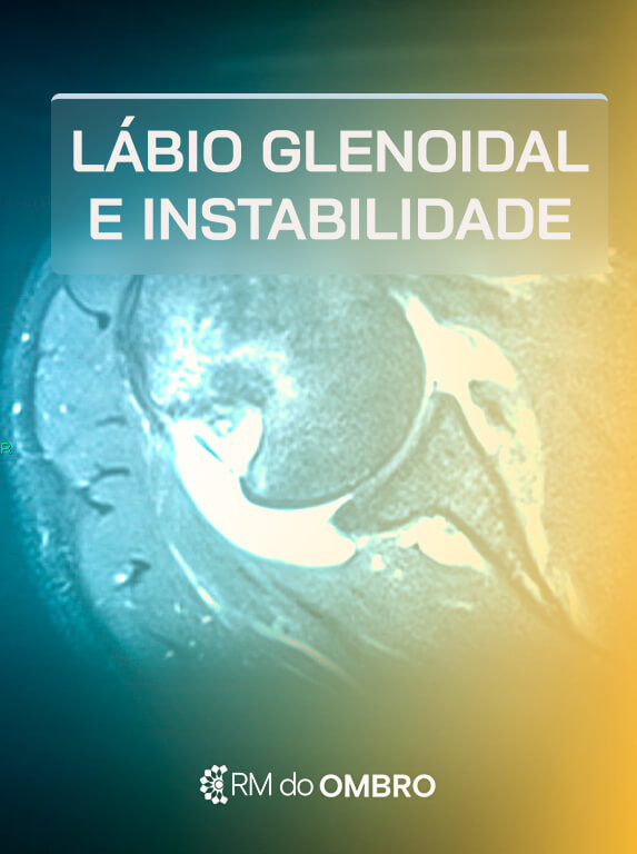 MÓD 3 - GLENOIDAL