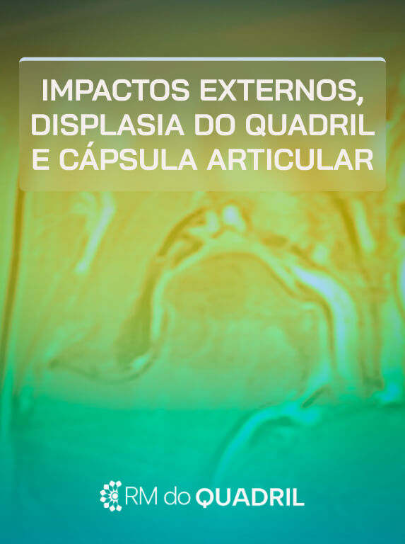 MÓD 3 - IMPACTOS EXTERNOS