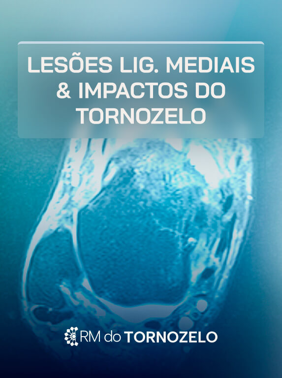 MÓD 3 - Lesões Lig. MEDIAIS