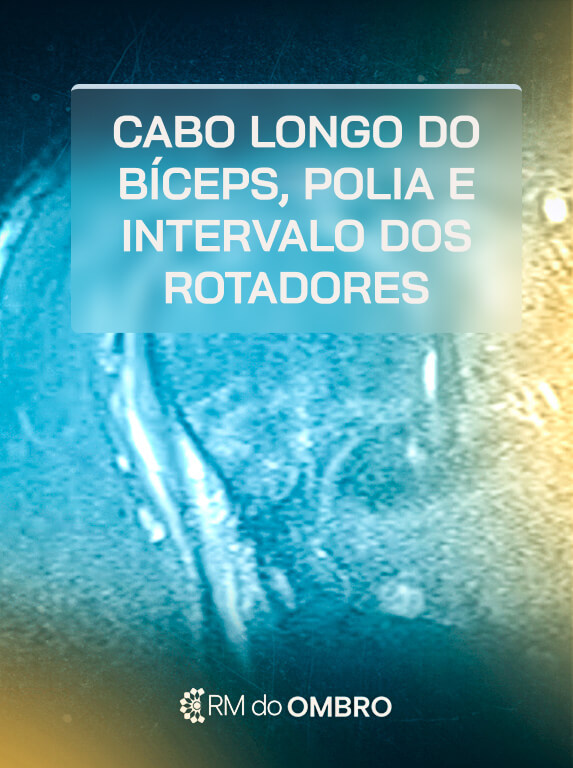 MÓD 4 - CABO LONGO BÍCEPS