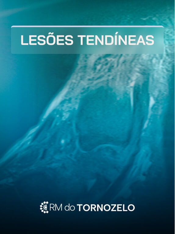 MÓD 4 - LESÕES TENDÍNEAS