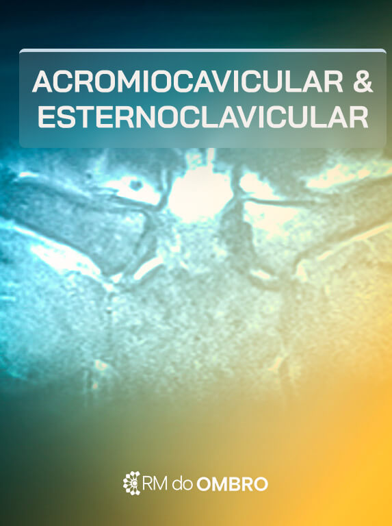 MÓD 5 - ACROMIO