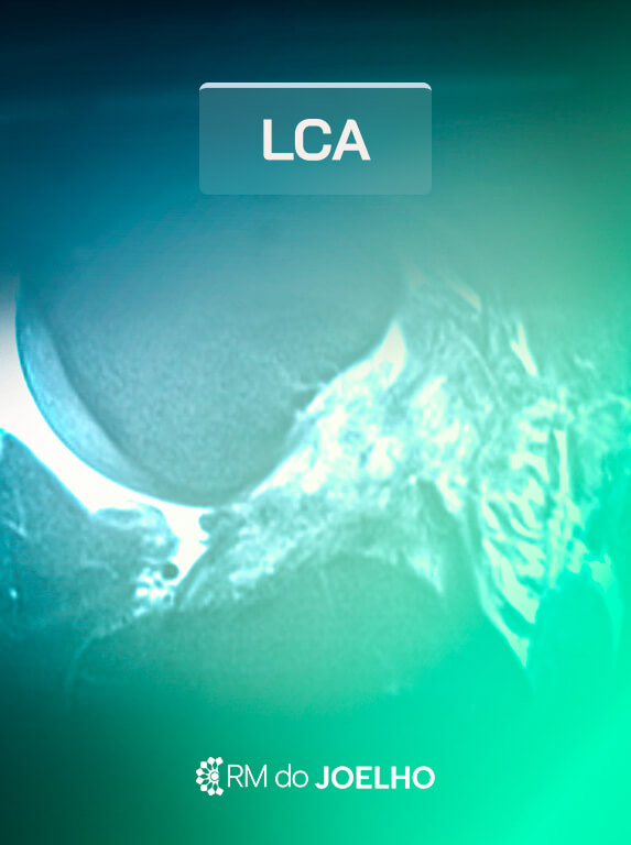 MÓD 5 - LCA