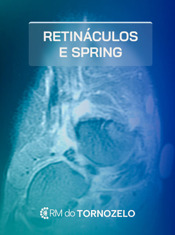 MÓD 5 - Retináculos e Spring