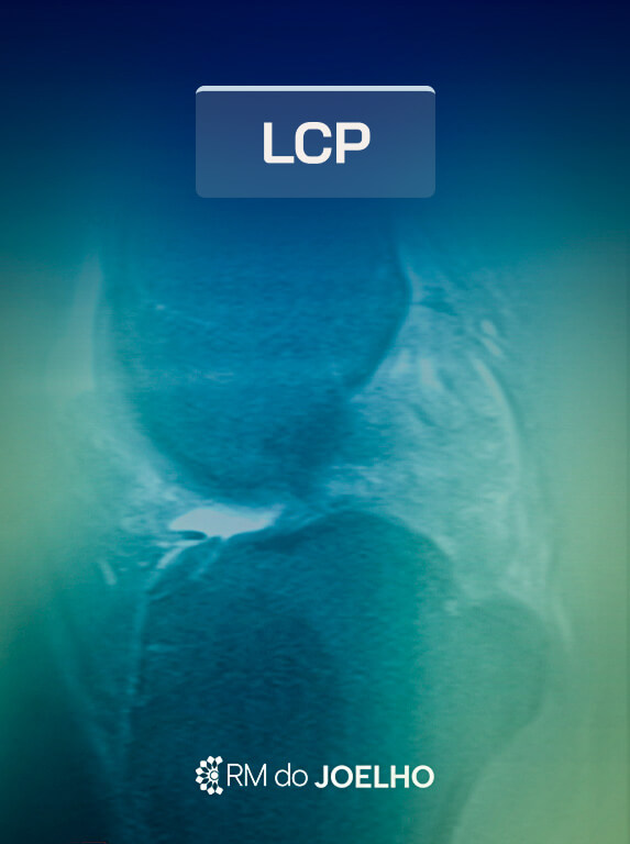 MÓD 6 - LCP