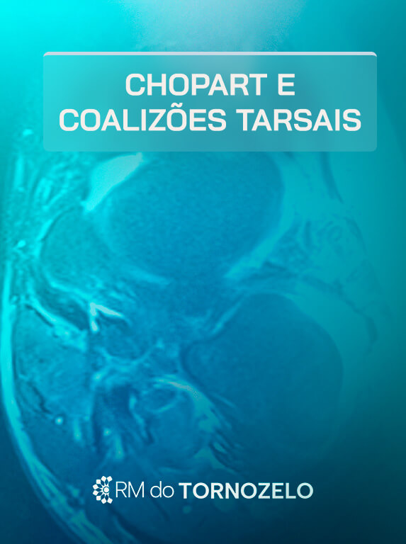 MÓD 7 - Chopart e Coalizões Tarsais