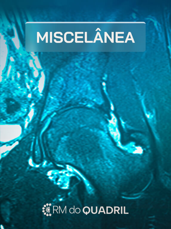 MÓD 7 - MISCELÂNEA