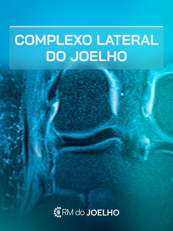 MÓD 8 - COMPLEXO LATERAL