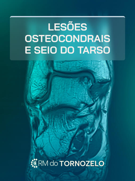 MÓD 8 - Lesões Osteocondrais e Seio do Tarso