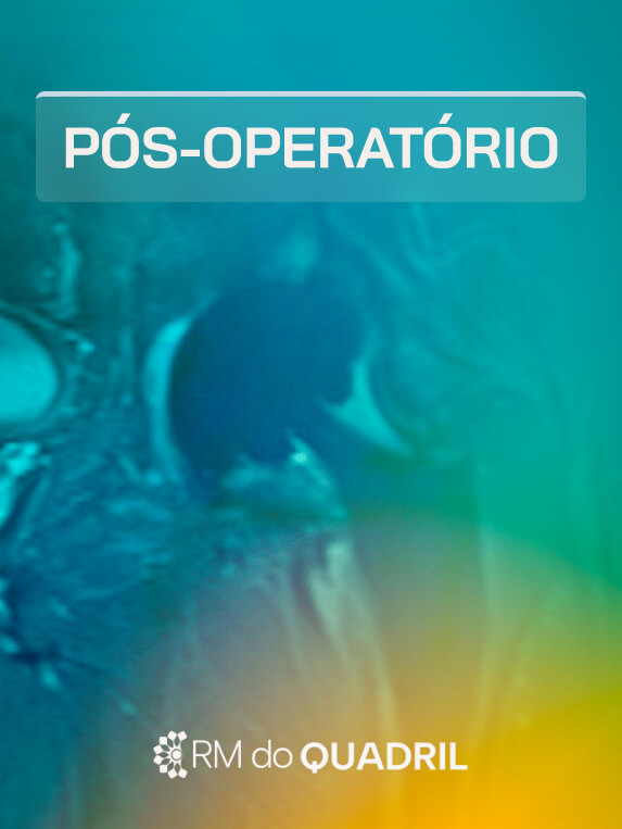 MÓD 8 - PÓS OPERATÓRIO DO QUADRIL